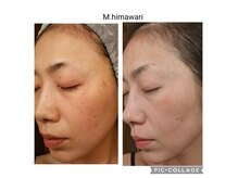 エムヒマワリ(M.himawari)の雰囲気（【シミ改善プログラム】期間限定!無料カウンセリングあり）