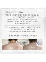 メディカルエステ 東銀座店/20代半ば 女性