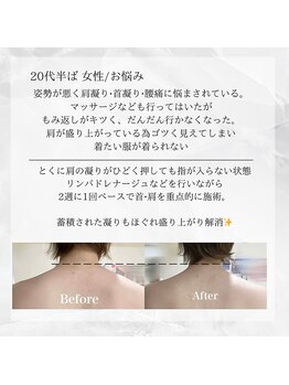 メディカルエステ 東銀座店/20代半ば 女性