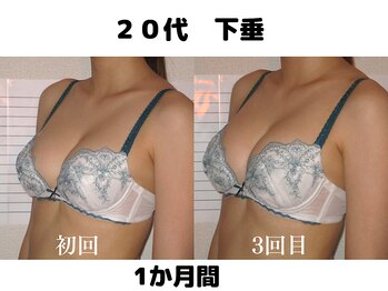 バストサロン メルベイユ(Merveile)/バスト位置UP