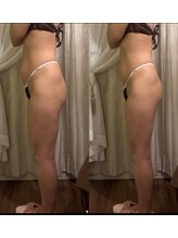 サロンハート(Salon Heart)/