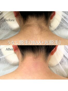 ナナイロサロン ニコリー(NaNairo nicolly)/【うなじワックス×光脱毛】