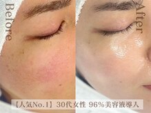 ディレイア ザ コスメ 有楽町マルイ店(direia the cosme)/赤み/ツヤ/くすみ［有楽町］