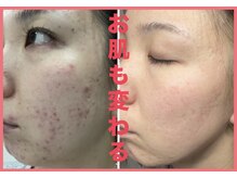 ヨサパーク アンジュ 大和田店(YOSA PARK Ange)の雰囲気（身体の中の要らないものを出す！身体のお掃除から始めましょう！）