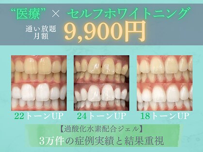 シカホワイトニングトウキョウ 笹塚店(CICA Whitening Tokyo)の写真