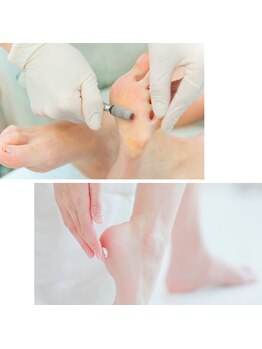 パールズ(PEARLS)の写真/【ガサガサかかとを卒業】頑固な角質足をぷるぷる潤う自慢の足へ大変身!