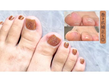 オー 町田モディ店(Oh!)の写真/【フットネイル専門店】巻き爪、足の深爪などのお悩みもお任せ！フットケア&カラーで足元から魅力的に！