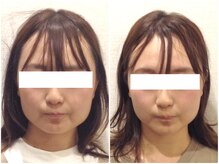 美容整体ウェリナ 名駅院/小顔矯正/骨盤矯正/美脚サロン