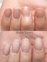 マリーロール 梅田店(Marie Laure)/自爪育成/深爪矯正/ネイルケア
