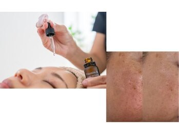 グロウスキン(GROW SKIN)/★そのお悩み栄養不足が原因？