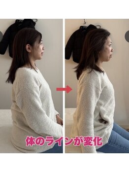 小顔22 ボルティ 本店(Bolty)/【悩み】体の厚み・肋骨の歪み