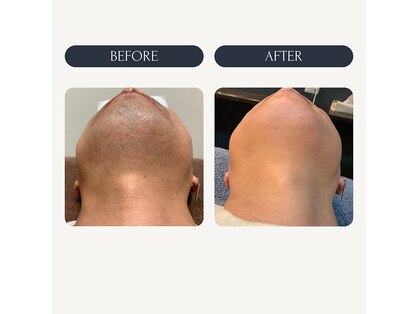 マリーローランメンズグレース(Marryrolan MensGrace)の写真