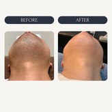 マリーローランメンズグレース(Marryrolan MensGrace)