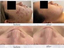 リモアボーテ(RIMOA beaute)