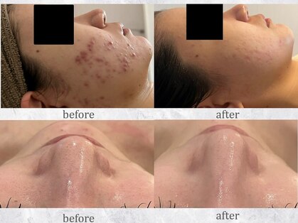 リモアボーテ(RIMOA beaute)の写真