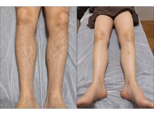 エタニティ 北花田店(Eternity)/【メンズ脱毛】