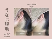 アルゴ 山口宇部店(ALGO)の雰囲気（《ショット数4倍》脱毛未経験者様、経験者様にも満足のお声多数!）