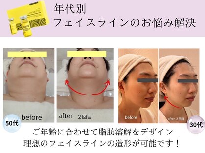 クリニカルエステ イーズ あべのキューズタウン店の写真