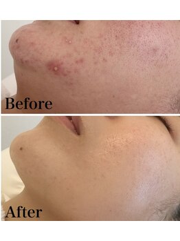 スリリアン 銀座/★お客さまビフォーアフター★