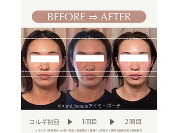 アイミーボーテ(Aime beaute)/コルギ