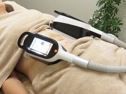 エタンセル(Etincelle)の写真