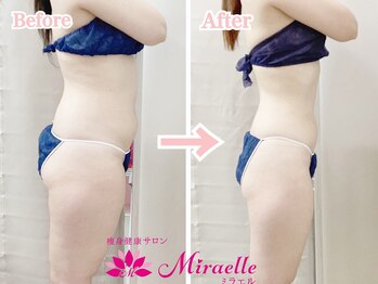 ミラエル(Miraelle)