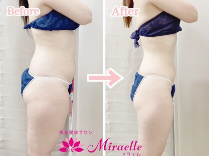 ミラエル(Miraelle)の写真