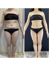 マシェリ(Ma che'rie)/ボディラインをスッキリ