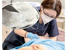 白髪・まばら・硬毛化など『残ってしまった毛』のための本格脱毛