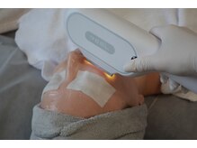 チョクチョクサロン(CHOKCHOK. Salon)/顔脱毛