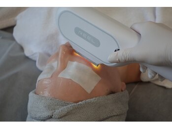 チョクチョクサロン(CHOKCHOK. Salon)/顔脱毛