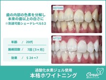 クレア(Crea)/【ホワイトニング症例写真】