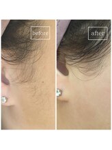 スムース(SMOOTH)/もみあげWAX　板橋/高島平/西台