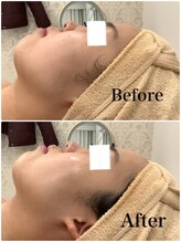 スペチアーレ 夙川/小顔と美肌で無敵の美顔