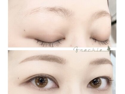 フレックル(freckle)の写真