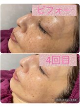 ビューティーサロン キャンディ 海老名(Candy)/