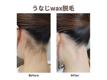 セリシエル(cericiel)の雰囲気(うなじはワックス脱毛でスッキリ綺麗に!)