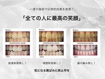 ホワイトニングショップ 焼津店
