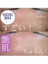 シエル(CIEL)/マリムーブフェイシャルワックス