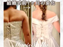 マリスステラ 天王寺(MarisStella)/ブライダルエステ1ヶ月の変化☆