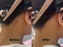 クイーン(QUEEN)/髪の毛アップするならこれ!!