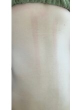 鍼灸庵利央/背中の経絡