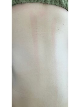 鍼灸庵利央/背中の経絡