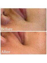 エルドットサナ(L.sana)/フェイシャルワックス