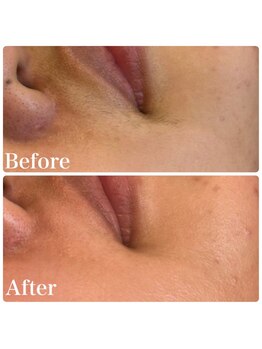 エルドットサナ(L.sana)/フェイシャルワックス