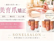 ソネル(SONEL)の雰囲気(☆当店独自の技術美育爪矯正で美しい爪へ!)