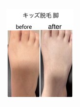 アオドットアール(Ao.r)/サンダルを履くのが楽しくなる！