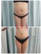 エスポワール(Espoir)の写真/【速効サイズダウン】狙った箇所の集中ケア！悩みや体質に合わせたオーダーメイド施術で理想体型へ
