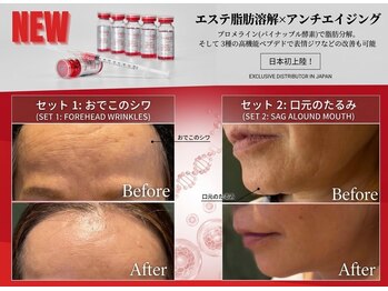 美ネージュの写真/老け見え解消！レッドショット×レモンボトルで根本改善。最新リフトアップでハリツヤ肌