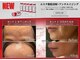 美ネージュの写真/老け見え解消！レッドショット×レモンボトルで根本改善。最新リフトアップでハリツヤ肌